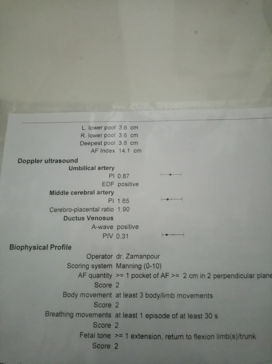 تفسیر سونو رشد و وزن وحرکت وخونرسانی جنین