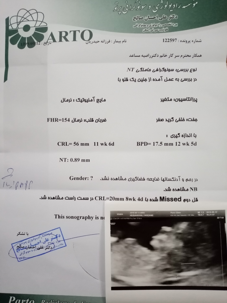 سلام میشه نظرتونو در مورد میزان ان تی من بگید لطفا