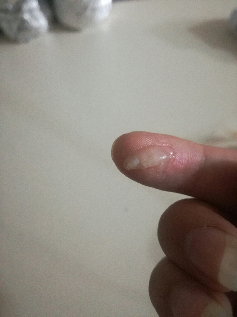 عکسه لطفا هر کی بدش میاد نیاد ممنون 🙏