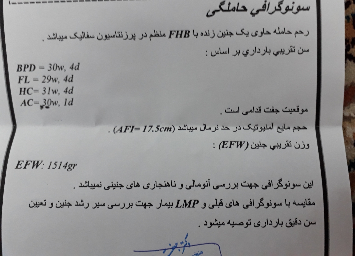 تفسیر سونو وزن