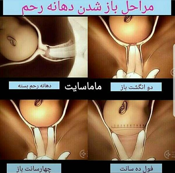 معاینه لگن چگونه است