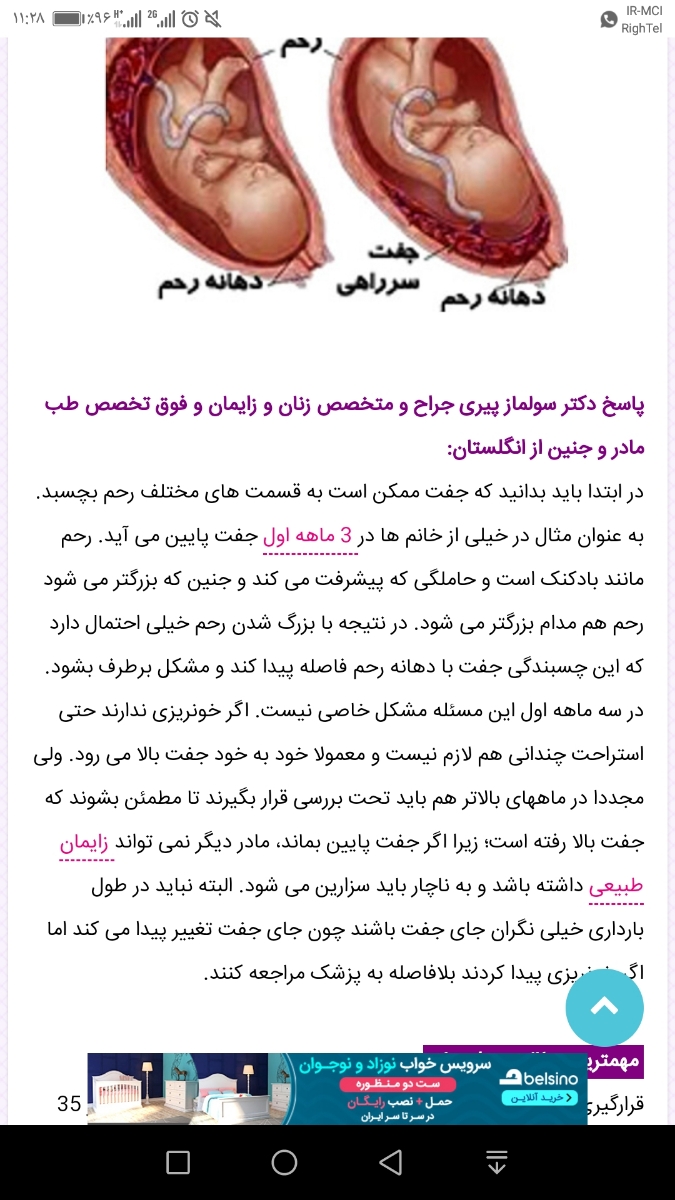 جفت پایین وبارداری..خیلی استرس دارم جفت پایین وبارداری..خیلی استرس دارم