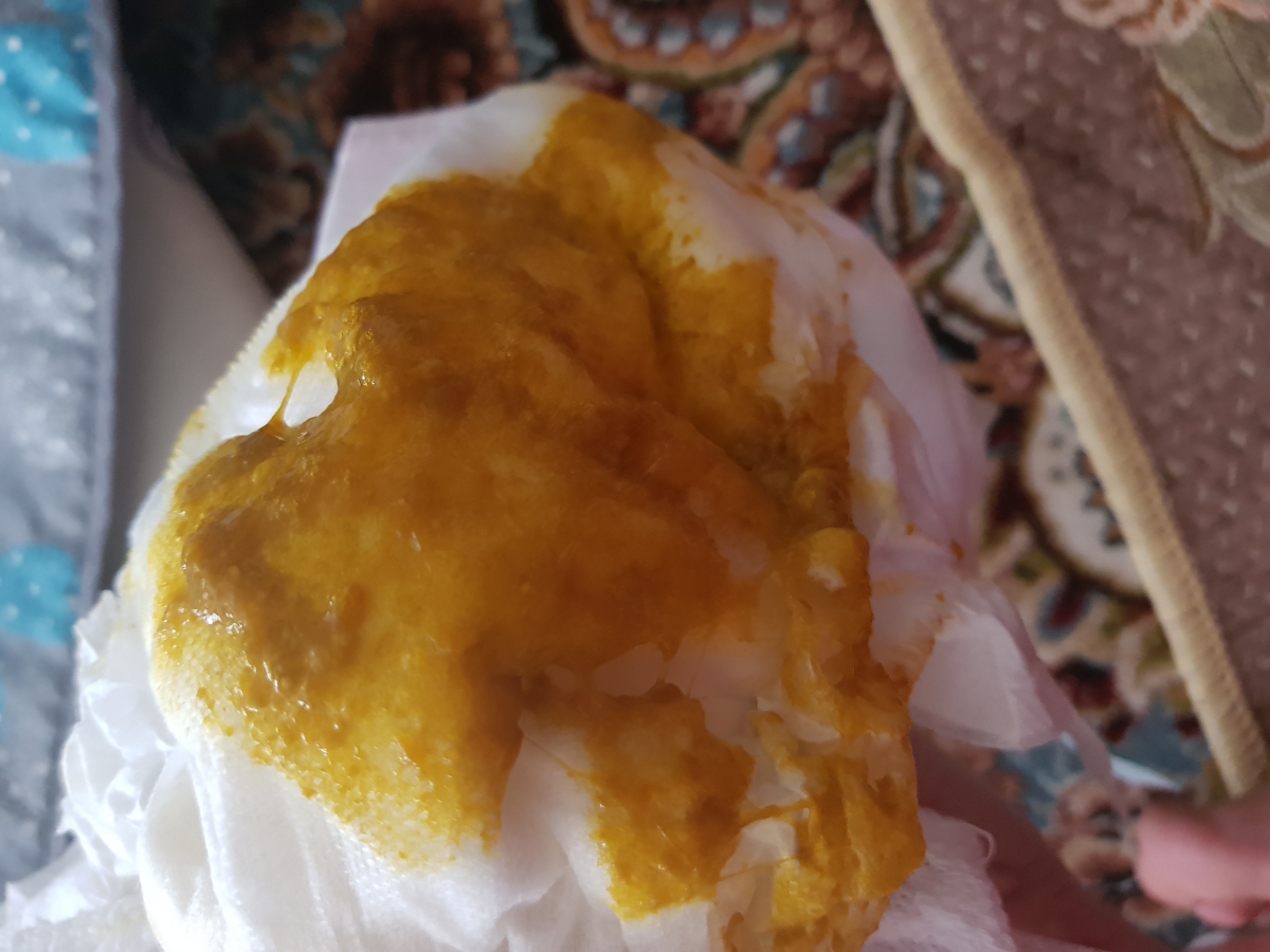 مدفوع نوزاد بعد هر بار شیر خوردن!!!