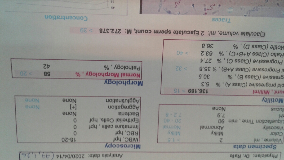 واریکسول خفیف آیا نیاز به جراحی دارد یا با دارو برطرف میشه