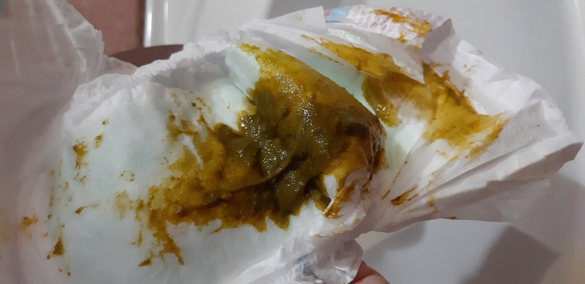 مدفوع نوزاد ۲ ماهه+عکس