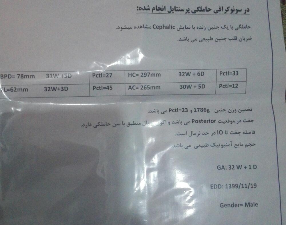 تفسیر سونوی وزن جنین