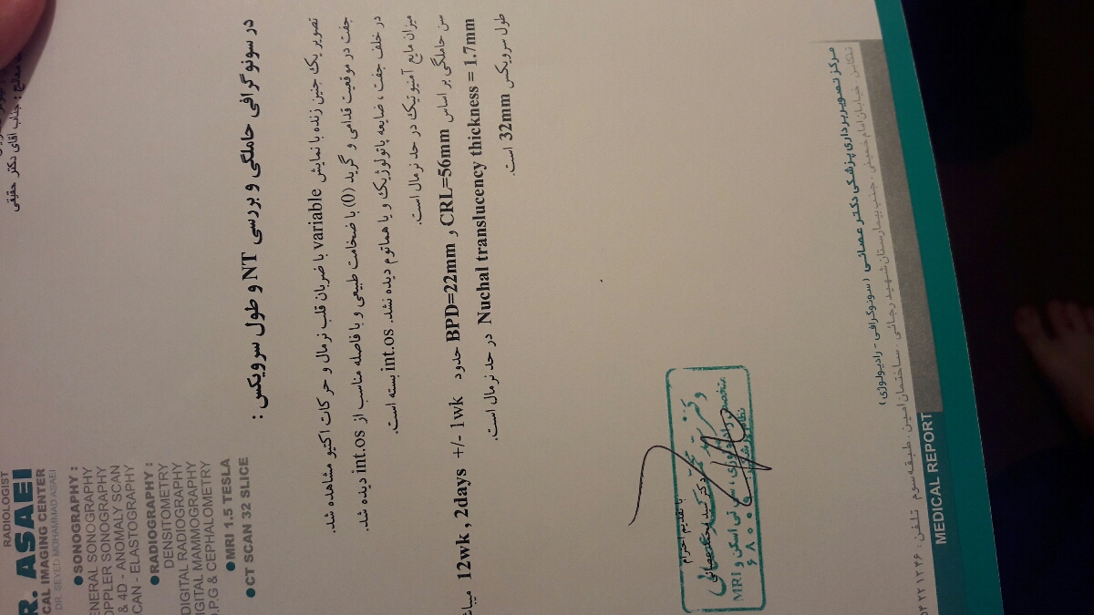 تعیین جنسیت جنین در سونو ان تی تعیین جنسیت جنین در سونو ان تی