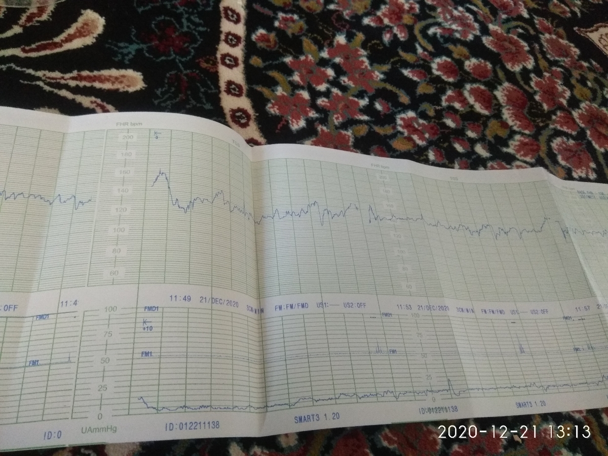 استفاده ازکپسول گل مغربی