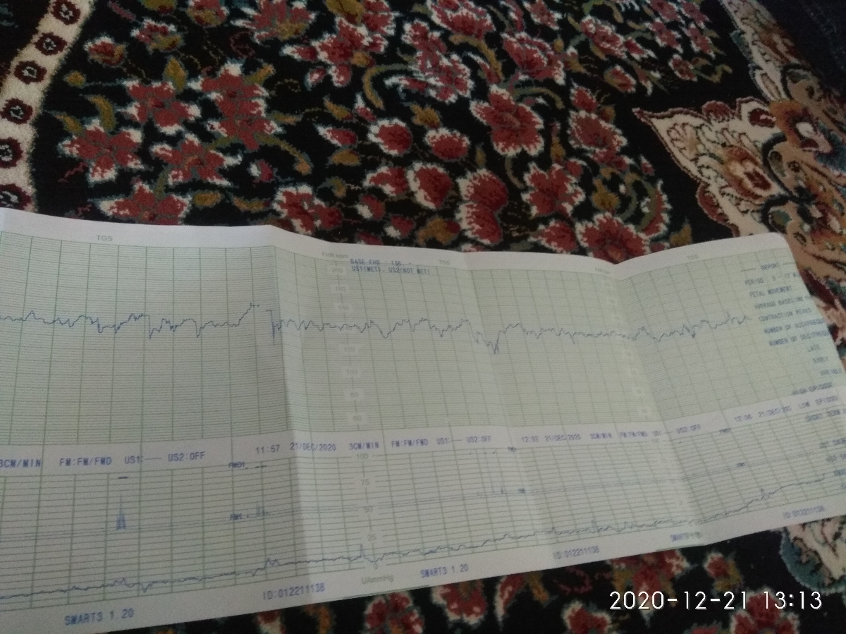 استفاده ازکپسول گل مغربی