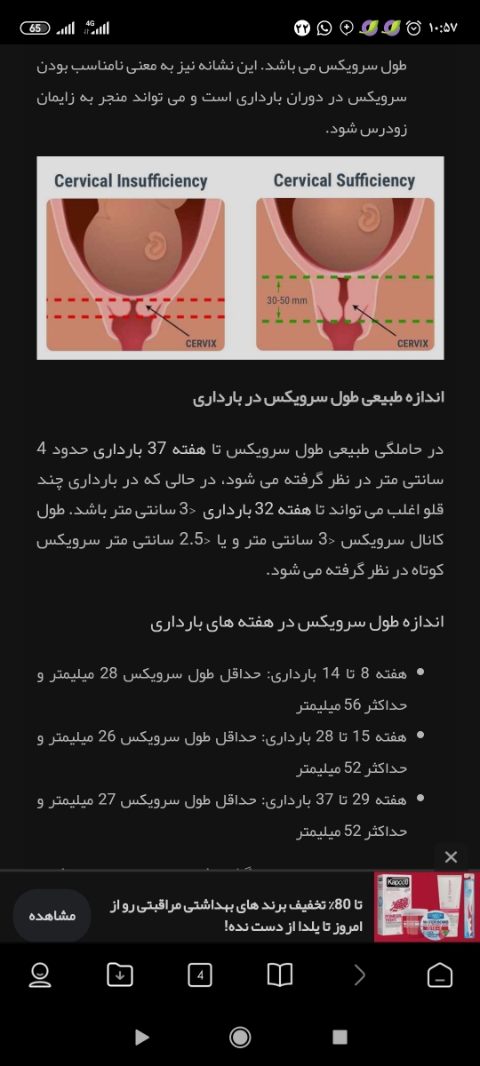 سلام خانمادکتر و خانمای عزیز میشه سونو منا تفسیر کنید ببینید خوبه یا نه ؟