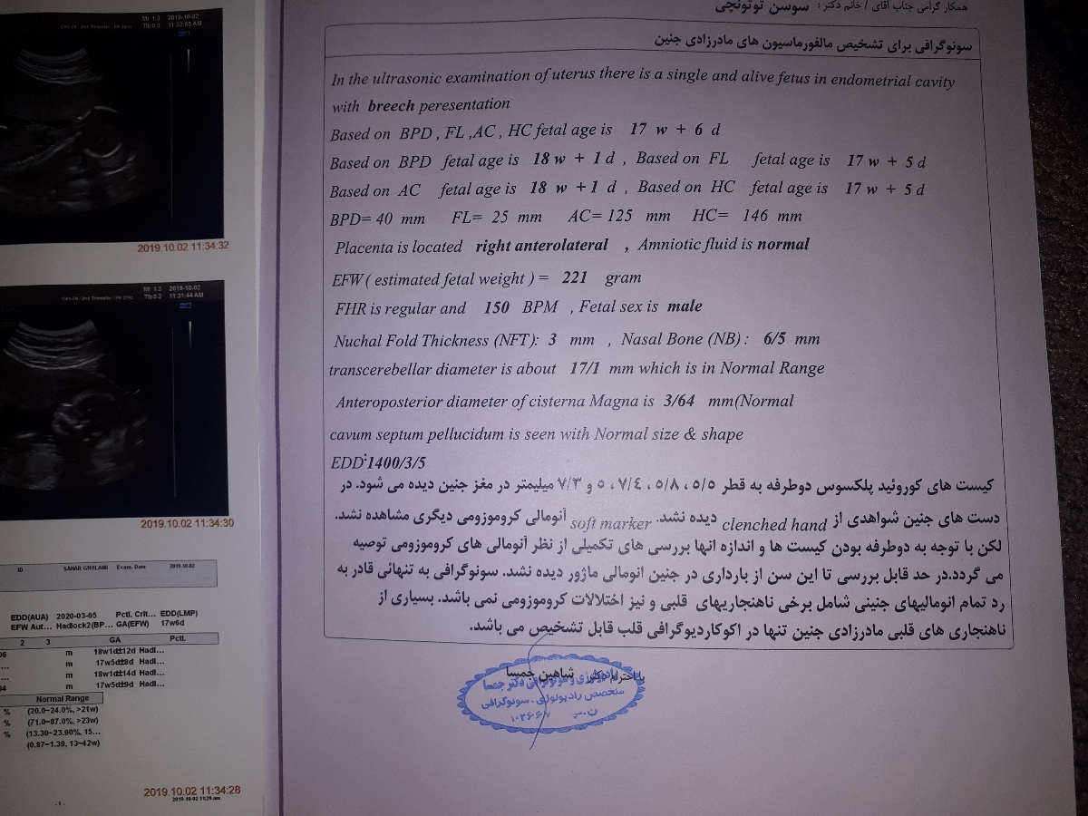 تفسیر سونو غربالگری دوم تفسیر سونو غربالگری دوم