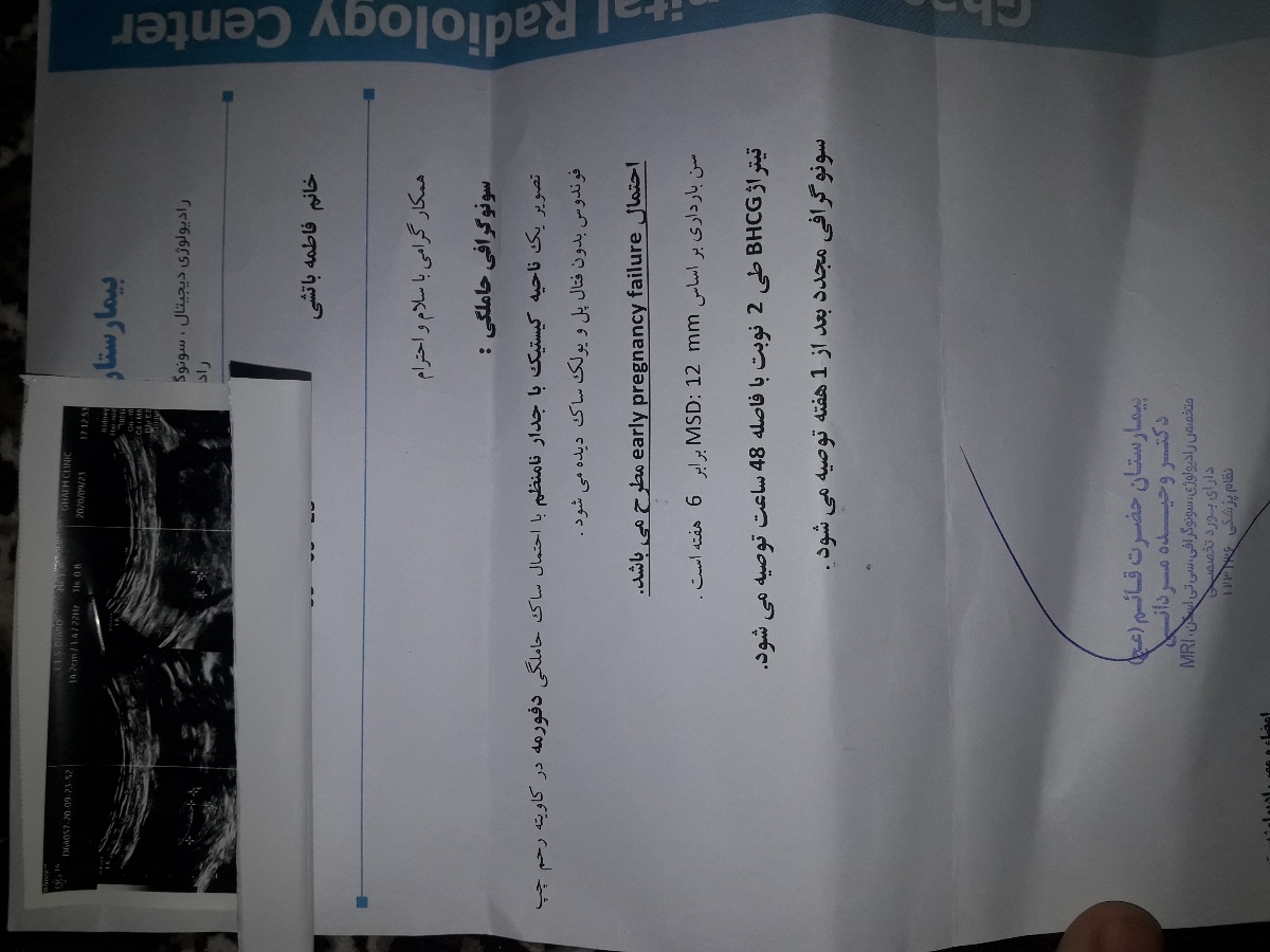 سلام خدمت پزشک اوما و دوستان.یه سونویی هست مال یکی اشناهان انجام داده بهش گفتن قلب بچه تشکیل نشده و باید سقط بشع با توجه ب ای سونو مشکلیه یا اینکه زوده برای قلب??