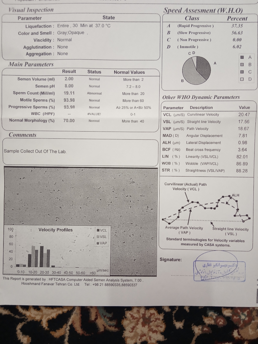 تفسیر ازمایش اسپرم م.