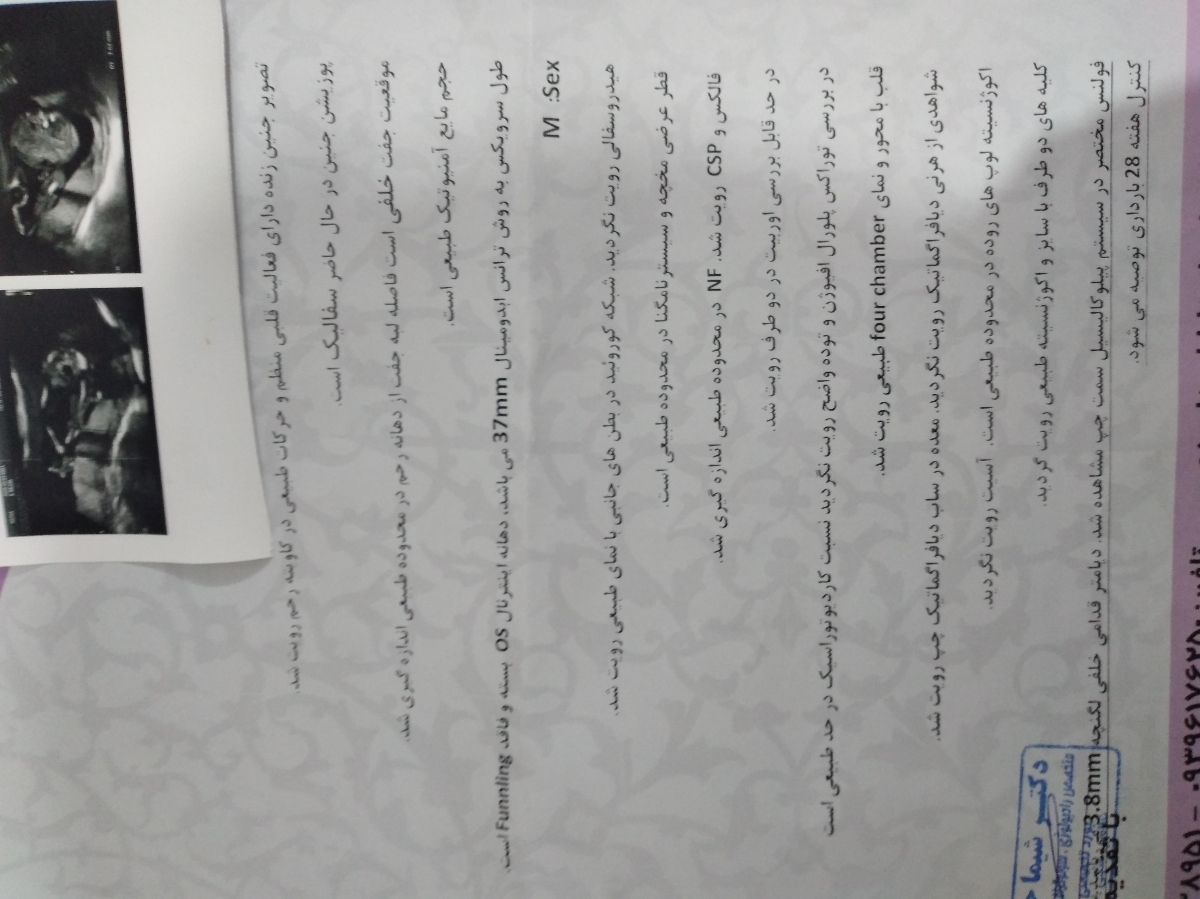تفسیر سونو گرافی انومالی