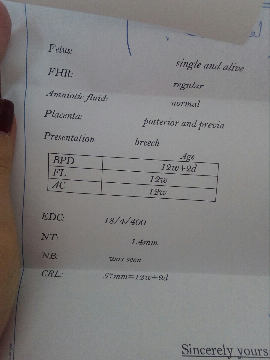 متخصصین محترم جنسیت بیایین بگین نینی خوشگلم جنسیتش چیه😍