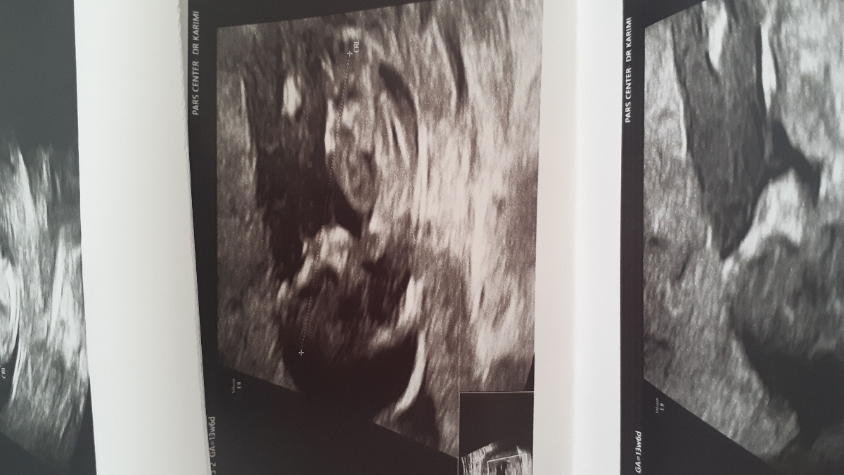 سلام خوبین بالاخره منم رفتم ان تی😁😍