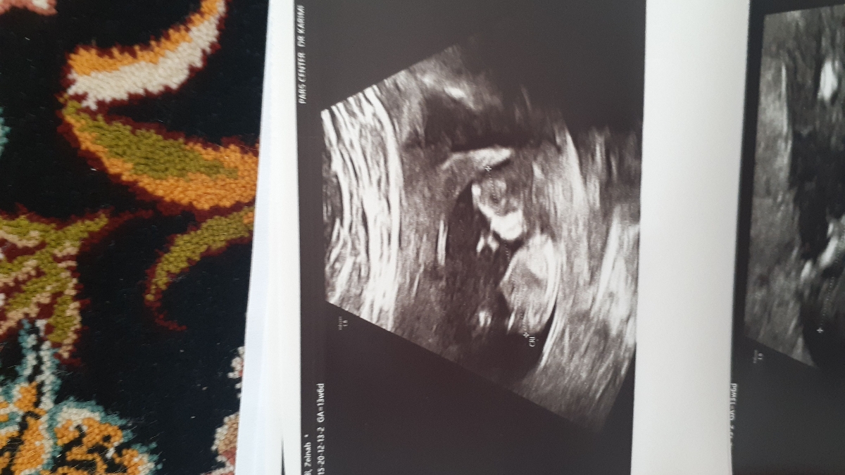 سلام خوبین بالاخره منم رفتم ان تی😁😍