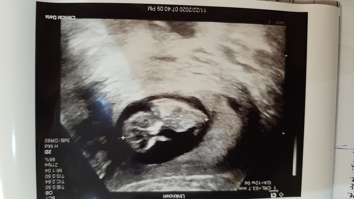 سلام خوبین بالاخره منم رفتم ان تی😁😍