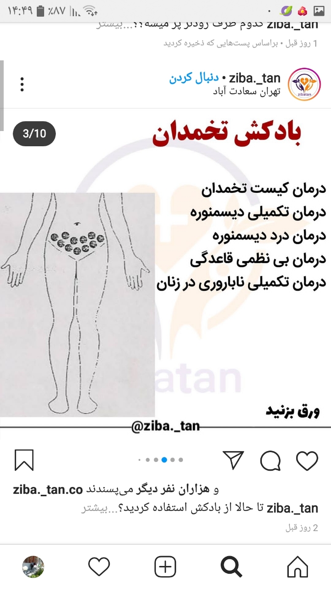 بادکش گرم تخمدان کسی تجربه داره؟