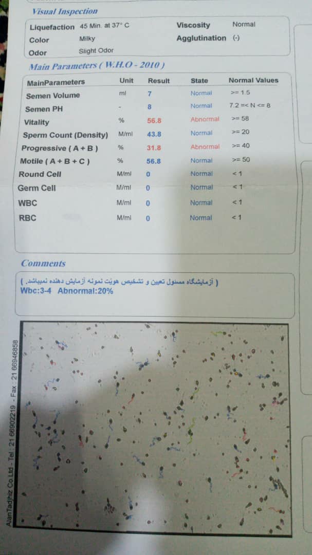 تفسیر آزمایش اسپرم لطفا