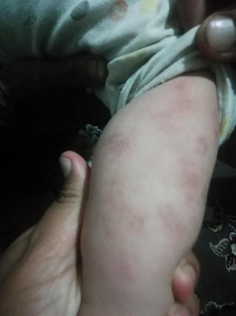 سلام دکتر جان میشه بگید که این چی میتونه باشه سلام دکتر جان میشه بگید که این چی میتونه باشه
