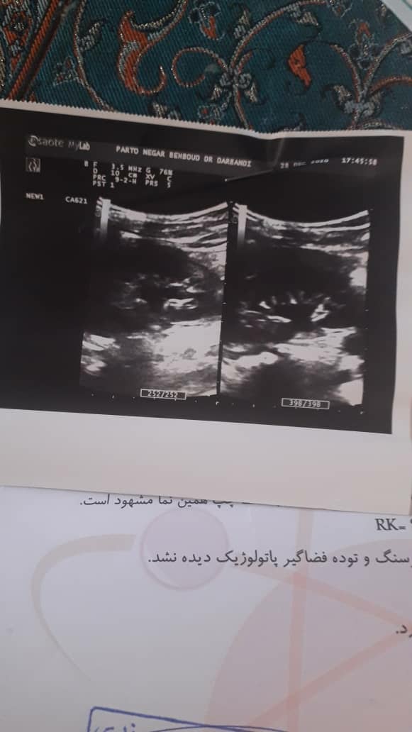 تفسیر سونو و ازمایش لطفا