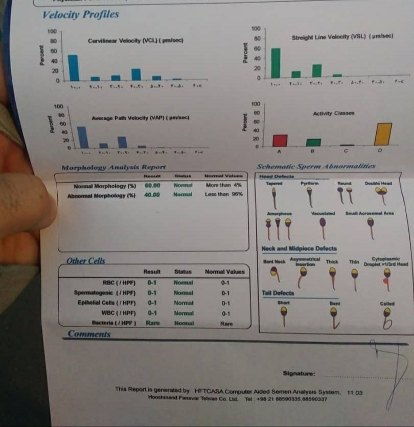 تفسیر آزمایش اسپرم