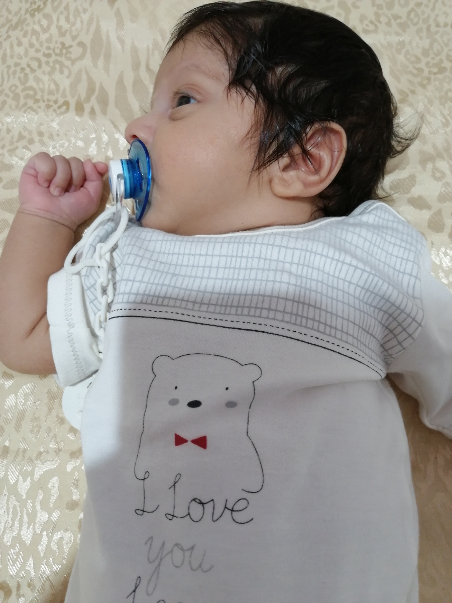 خشکی و جوش پوست نوزاد خشکی و جوش پوست نوزاد