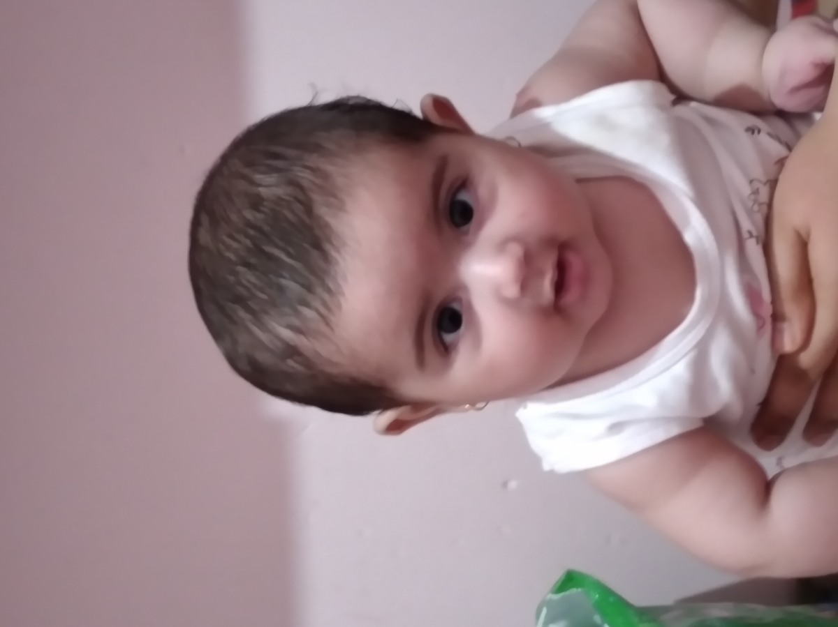 گوش های پسرم شبیه بادبزن شده😢😭 گوش های پسرم شبیه بادبزن شده😢😭
