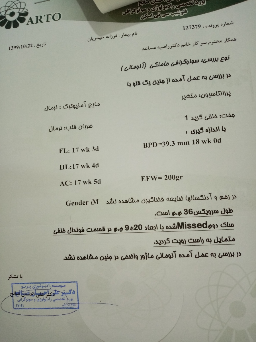 سلام منم رفتم آنومالی سلام منم رفتم آنومالی