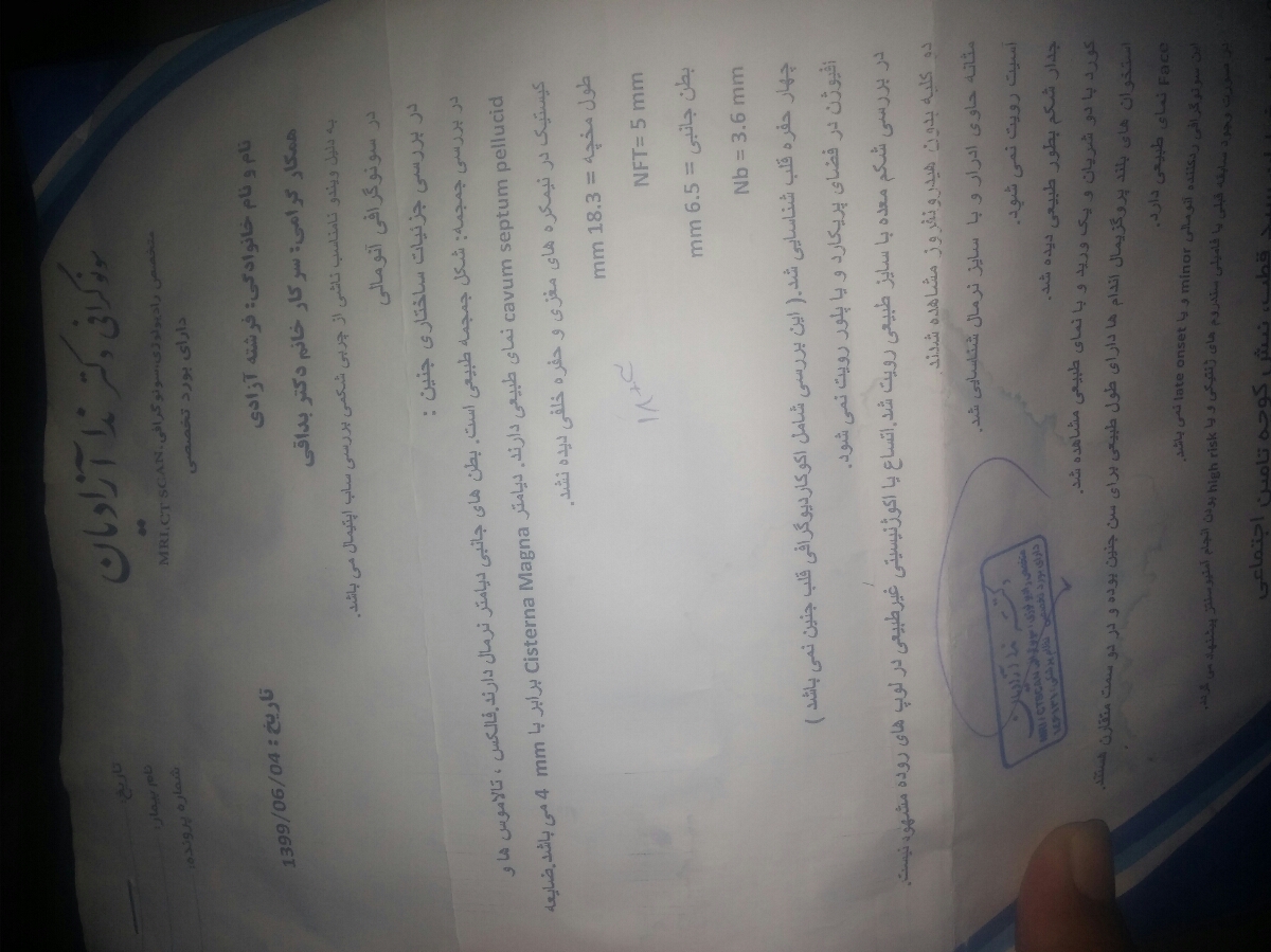 عقب موندن سه هفته ای از رشد سر