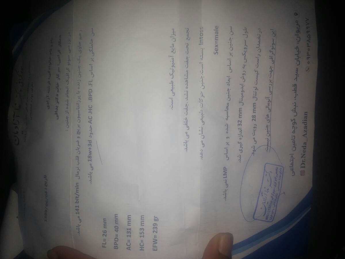 عقب موندن سه هفته ای از رشد سر