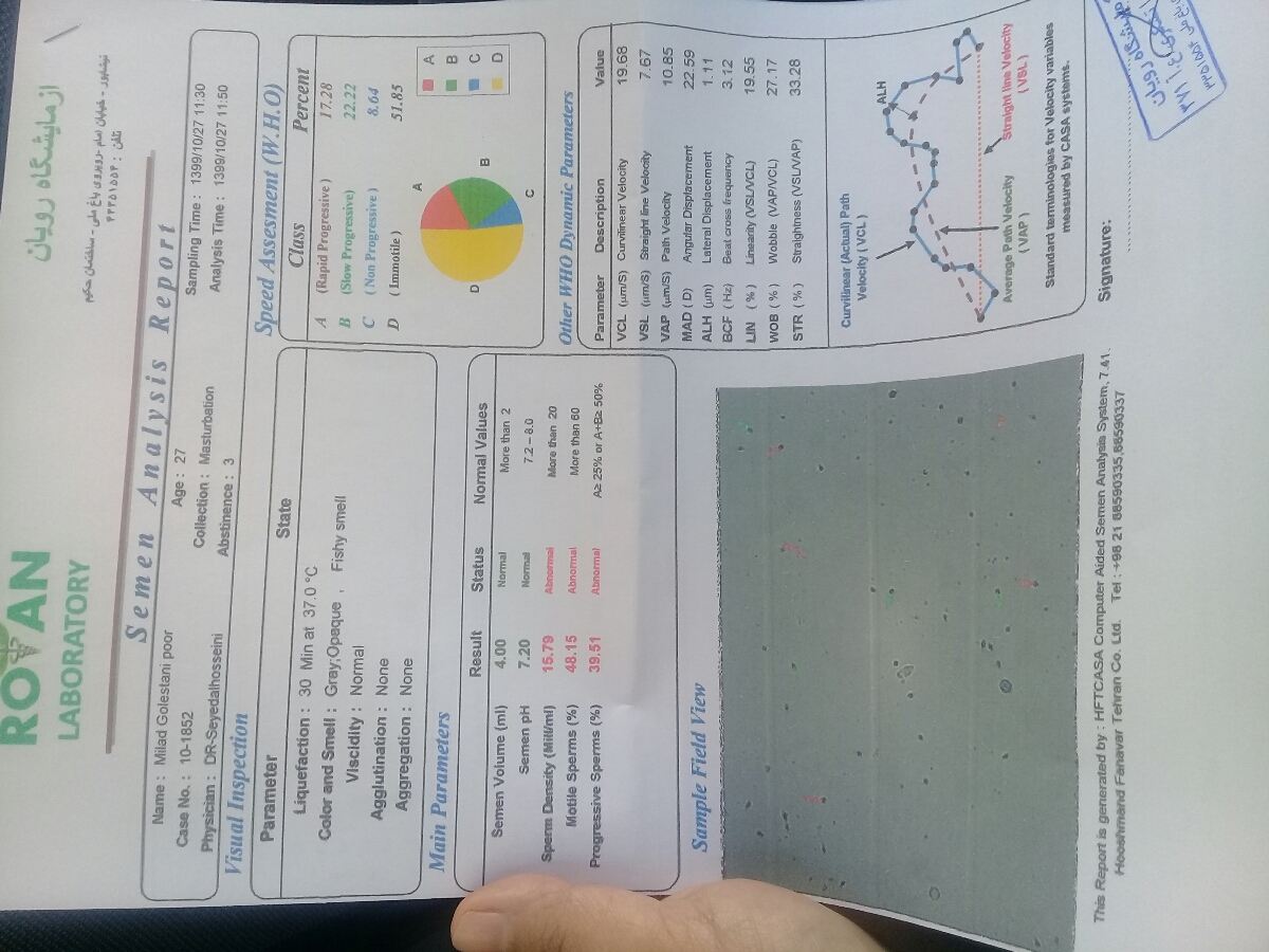 تفسیر ازمایش اسپرم شوهرم تفسیر ازمایش اسپرم شوهرم