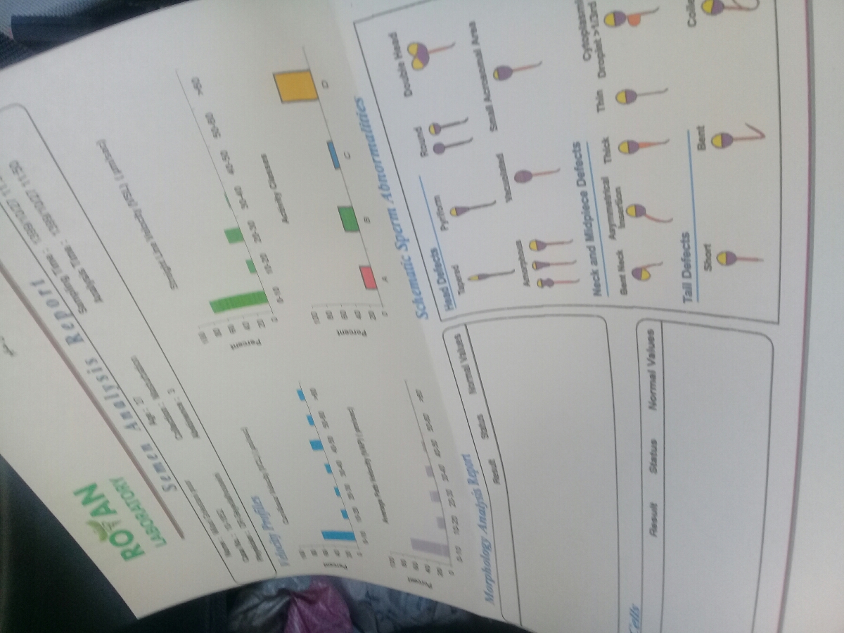 تفسیر ازمایش اسپرم شوهرم تفسیر ازمایش اسپرم شوهرم