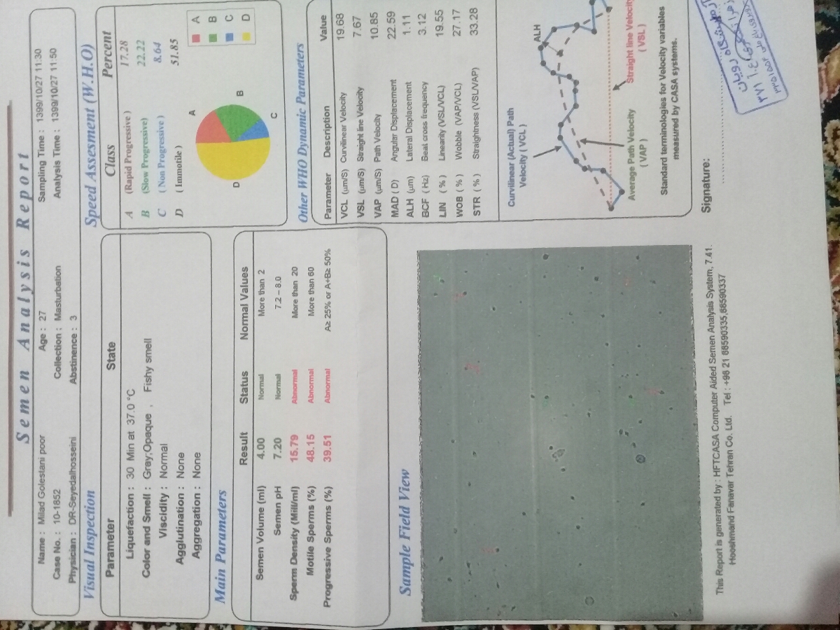 تفسیر ازمایش اسپرم شوهرم تفسیر ازمایش اسپرم شوهرم