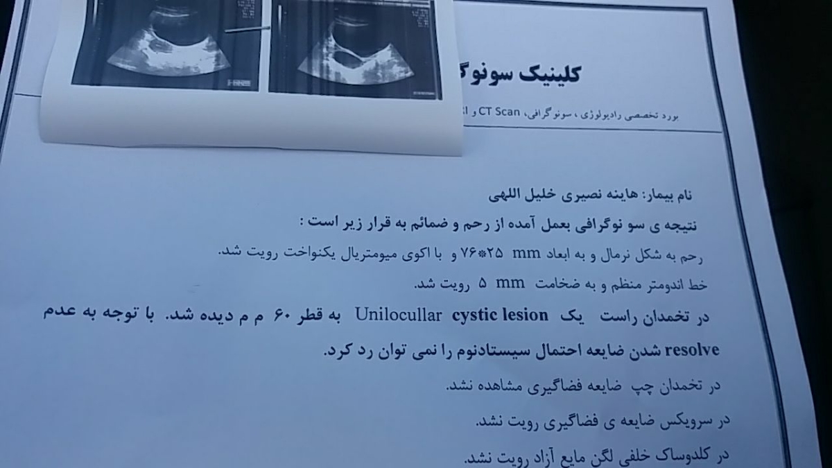 این سونوگرافی دوستمه یعنی چی