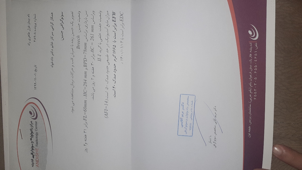 برسی سونو وزن جنین