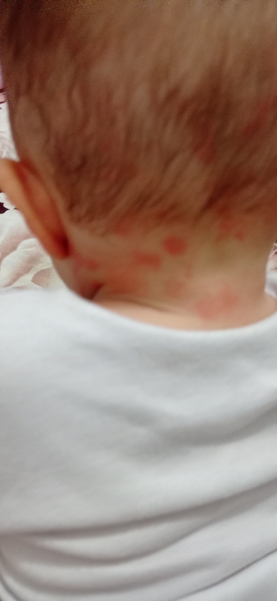 بچم تب میکنه فقط شبها