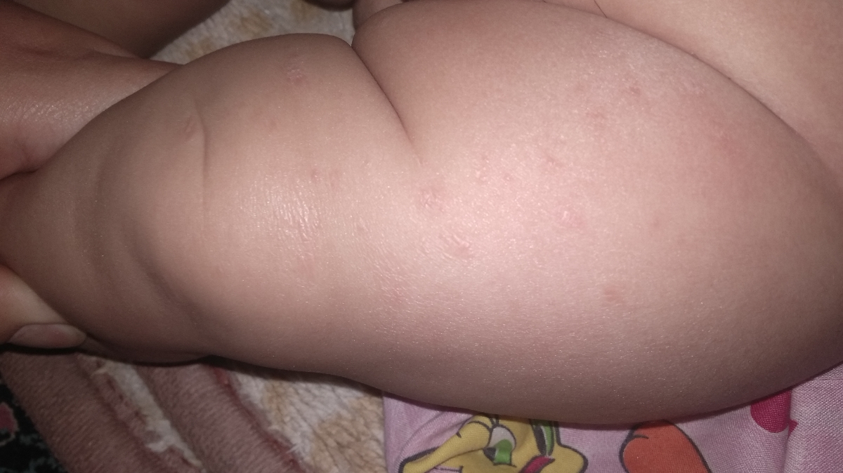 لطفا عکس و ببینید