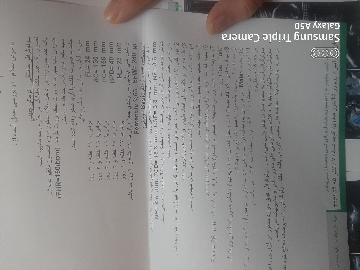 سلام میشه سونو آنومالی رو تفسیر کنید❤
