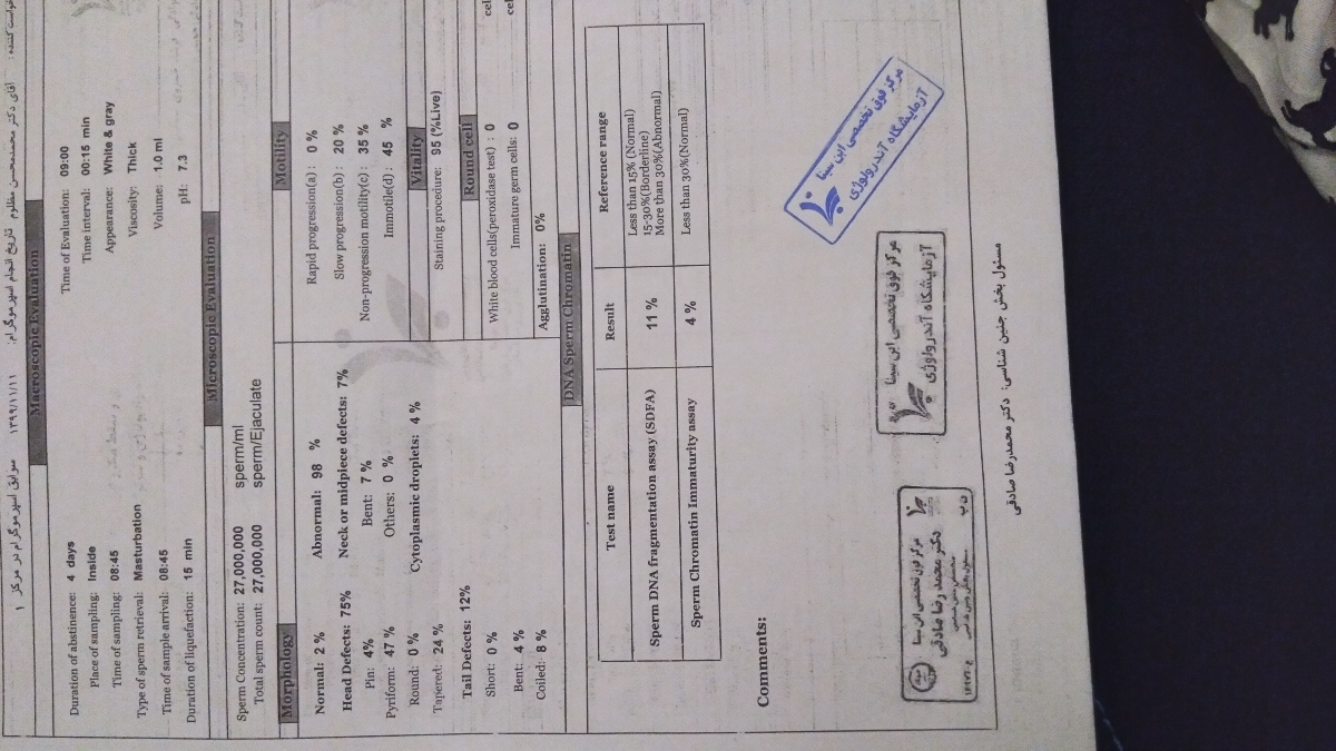 نتیجه آزمایش اسپرم همسرم نتیجه آزمایش اسپرم همسرم