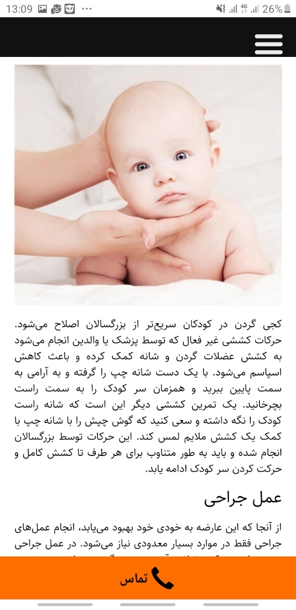 کج گرفتن گردن نوزاد کج گرفتن گردن نوزاد