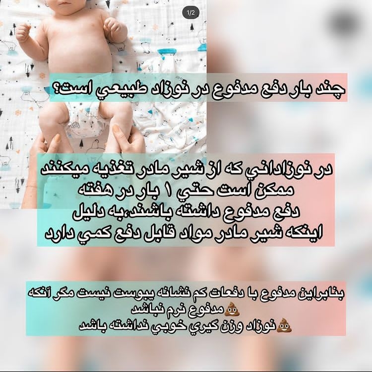 خانما سوالم در مورد مدفوع نوزاد هستش