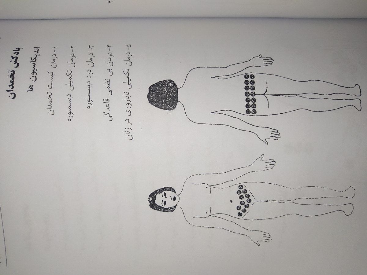 تنبلی تخمدان در بانوان تنبلی تخمدان در بانوان