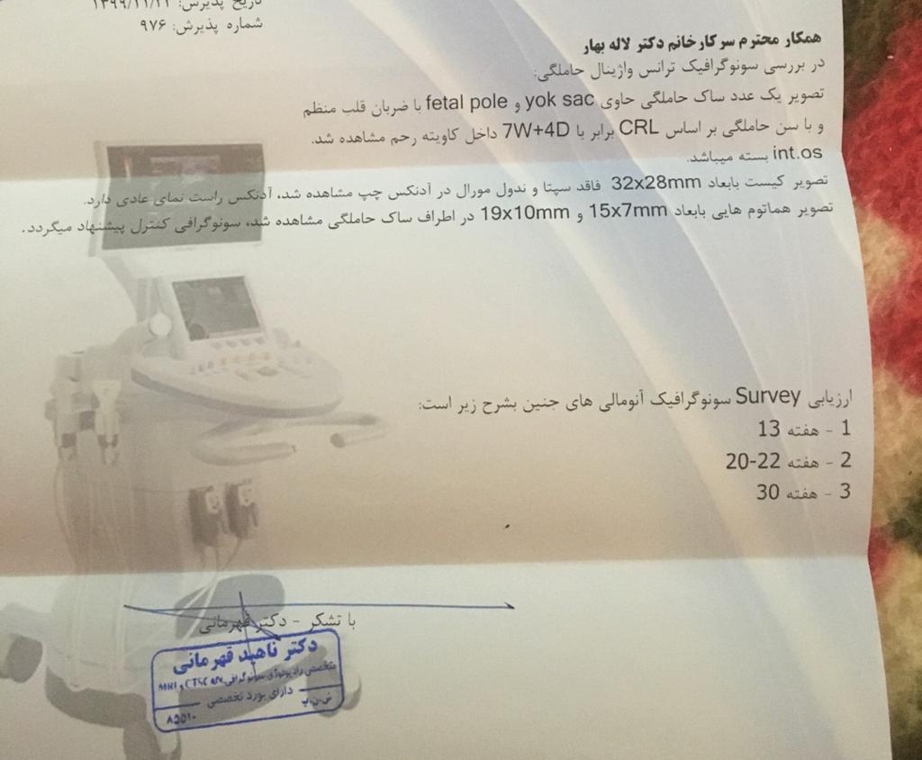 وجود هماتوم در اطراف ساک حاملگی