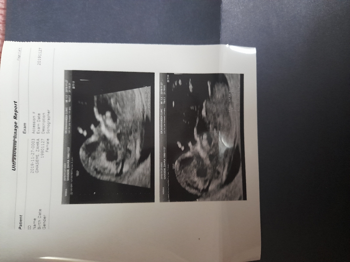 سلام خانما و اوما عزیز لطفا سونو غربالگری ببینین خوبه