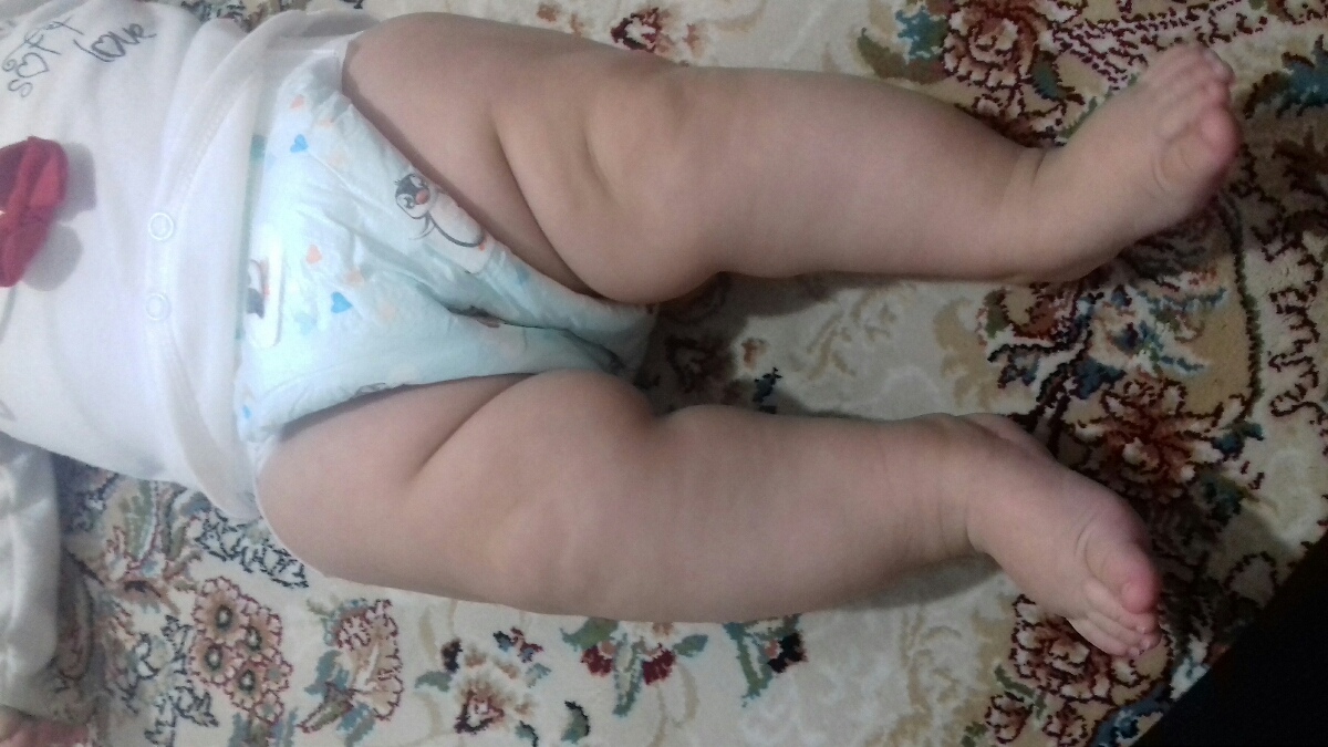 پای نوزاد شش ماهه