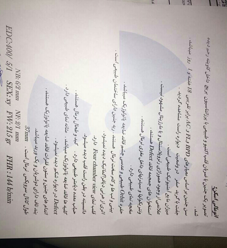 خانما توروخدا سونوی آنومالی منو میشه ببینید لطفا.