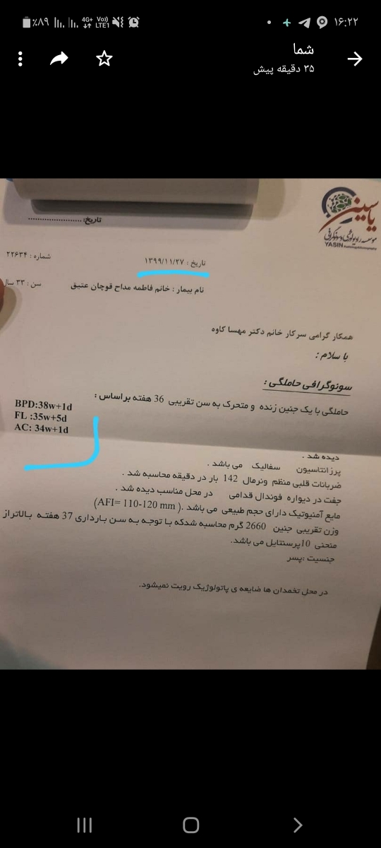 احتلاف fl در سونو گرافی هفته ۳۹ بارداری