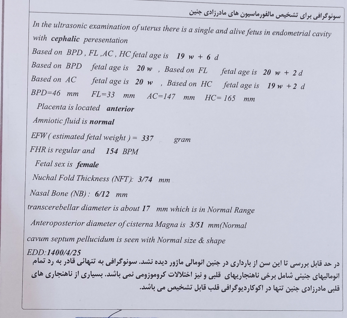 جواب سونوی آنومالی